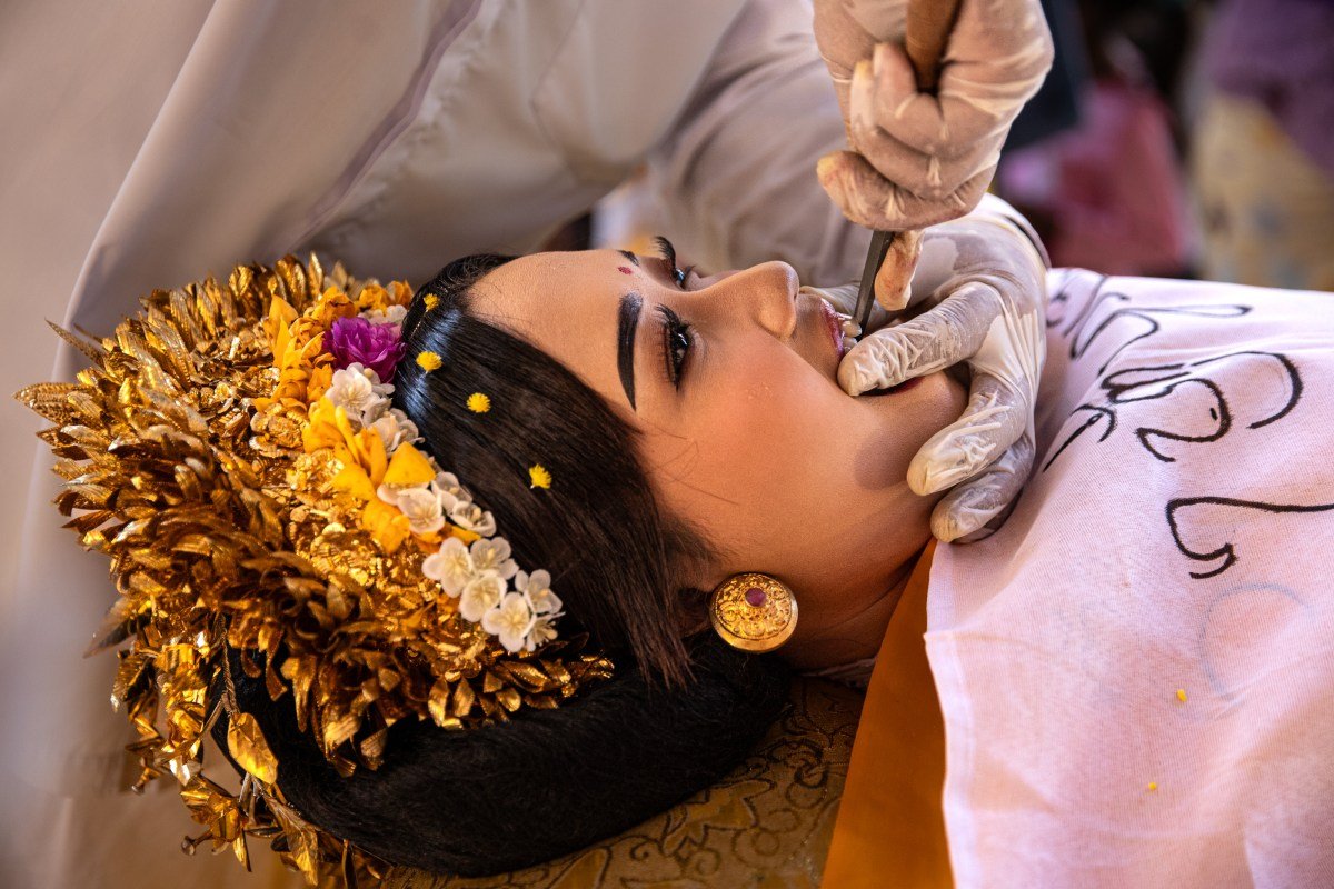 Hindu Balinese Devotees Hold Metatah Tooth Filing Ceremony